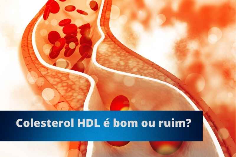 Colesterol HDL é bom ou ruim (1)