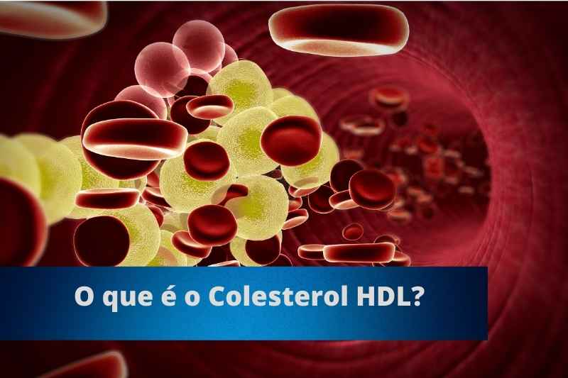 Colesterol HDL é bom ou ruim (3)