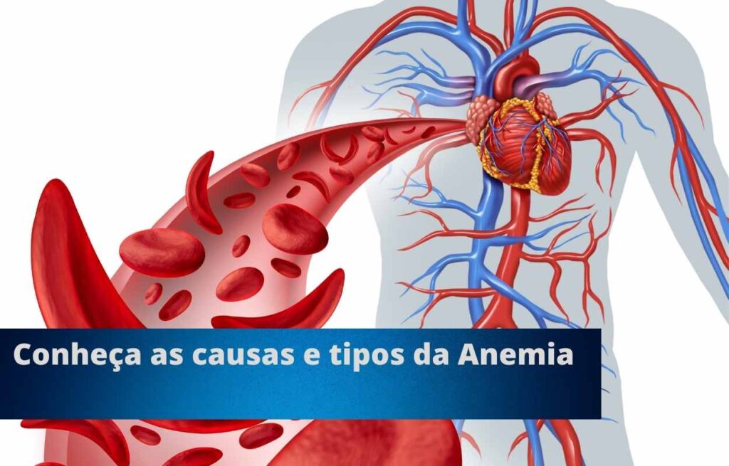 Conheça as causas e tipos da Anemia